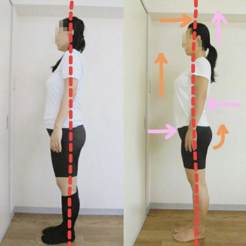 ビフォーアフター　Beforeafter 姿勢矯正　猫背矯正　姿勢改善　猫背改善　外苑前　南青山　骨格矯正　４０代女性