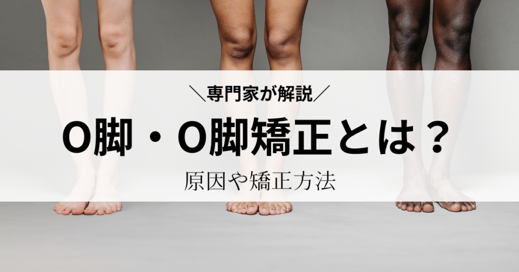 【O脚・O脚矯正とは？】原因や矯正方法