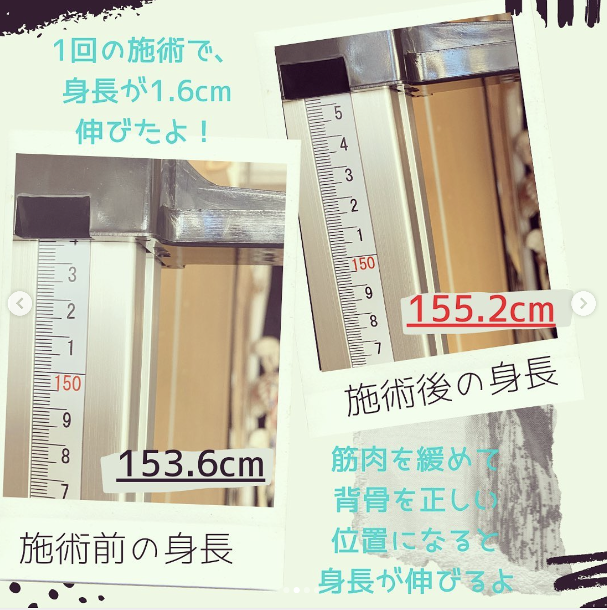 身長が伸びた実例写真
