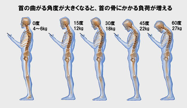 実は首が前にでると、小学生を肩車している状態と同じの図
悪い姿勢の特徴
