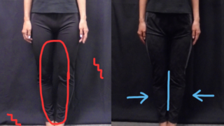 O脚矯正　南青山のO脚矯正院　O脚矯正の施術内容や効果
