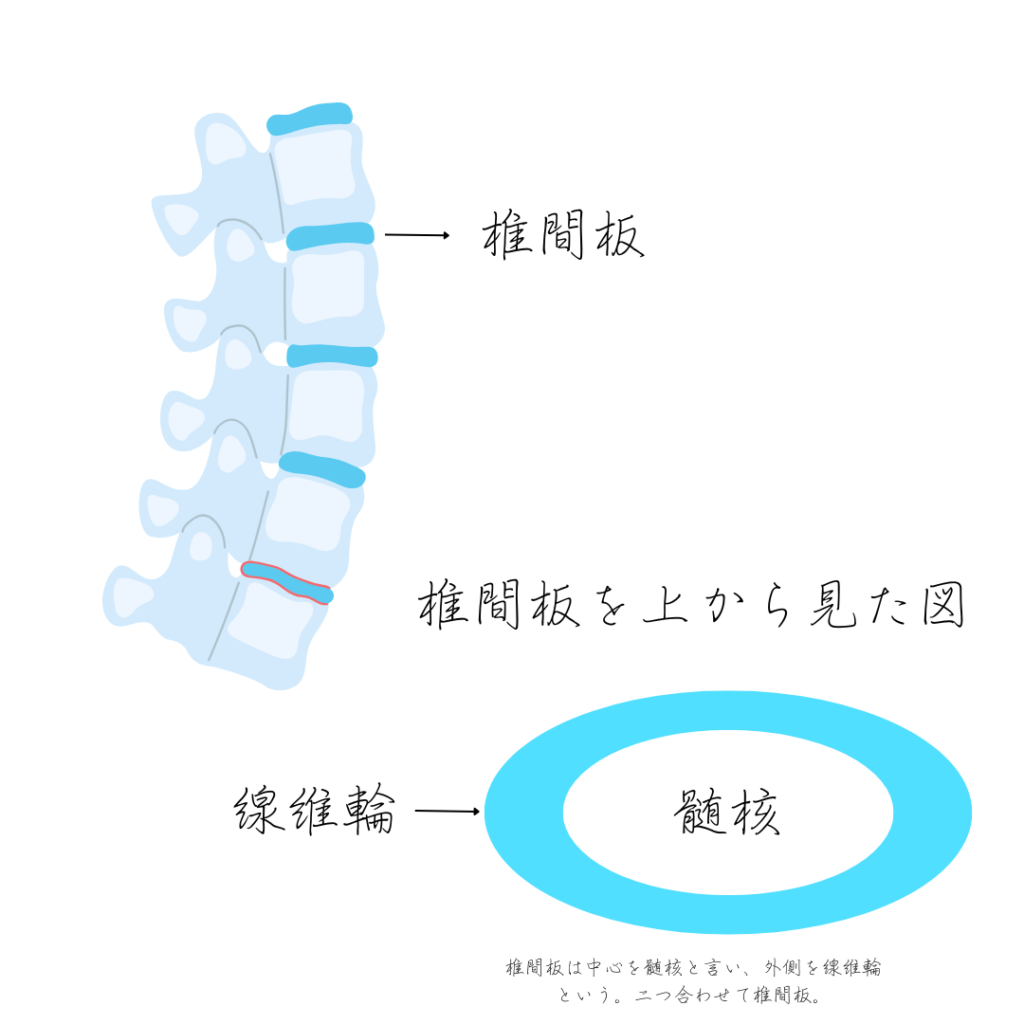 椎間板を説明した、お手製の図。